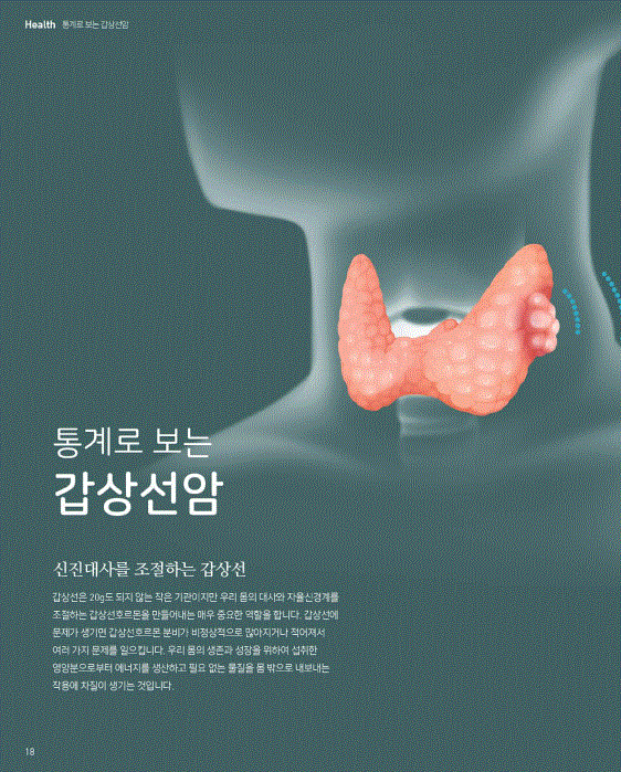 질환소개